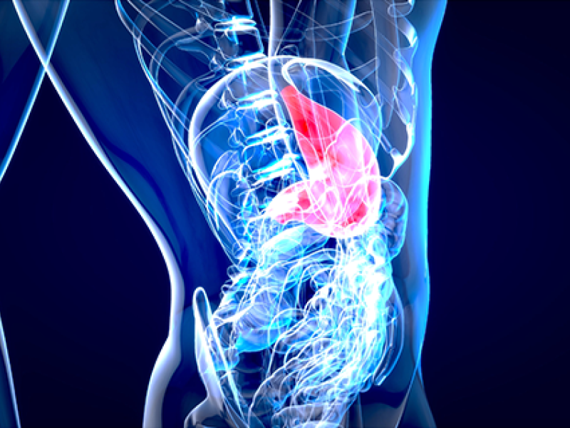 Manejo de pancreatitis crónica