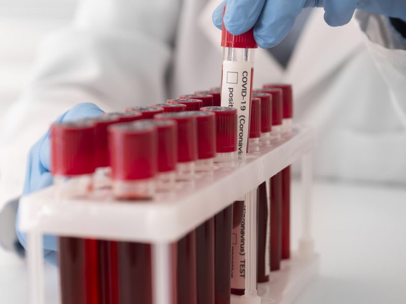 UNA MIRADA A LOS BENEFICIOS Y RIESGOS DE TRANSFUSIÓN DE GLOBULOS ROJOS.