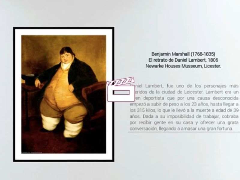 Endocrinología en el arte