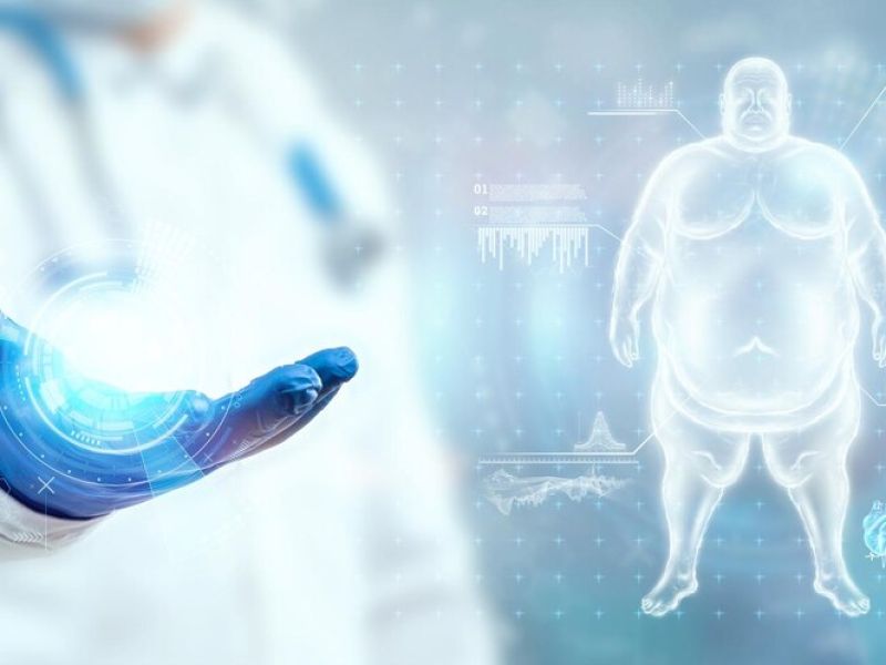 Clasificación clínica de la obesidad e implicaciones para la enfermedad del hígado graso asociada a disfunción metabólica