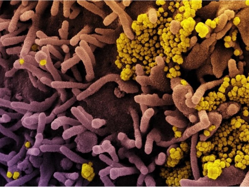 Una nueva proteína estaría relacionada con la transmisión del SARS CoV2