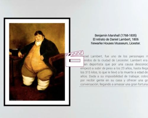 Endocrinología en el arte