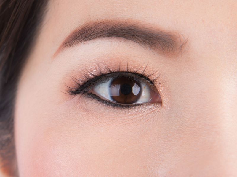 Impacto de las definiciones de envejecimiento normal y progresión en la especificidad de la tomografía de coherencia óptica para la detección del adelgazamiento de la capa de fibras nerviosas de la retina