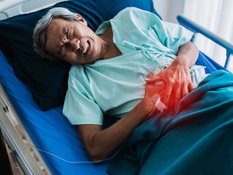 Identifican cuatro elementos asociados a un mayor riesgo de cáncer colorrectal de aparición precoz