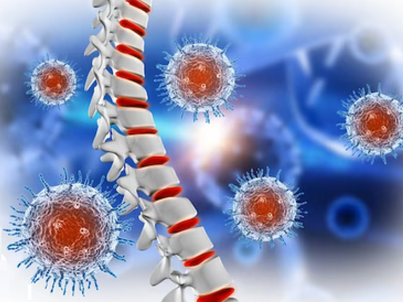 La inflamación causante de muchas enfermedades