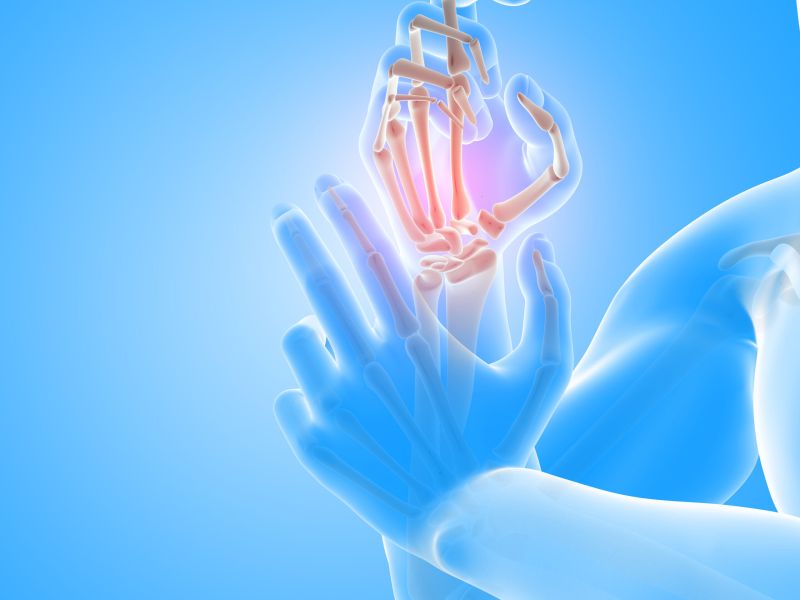 Actualización en arteritis de células gigantes