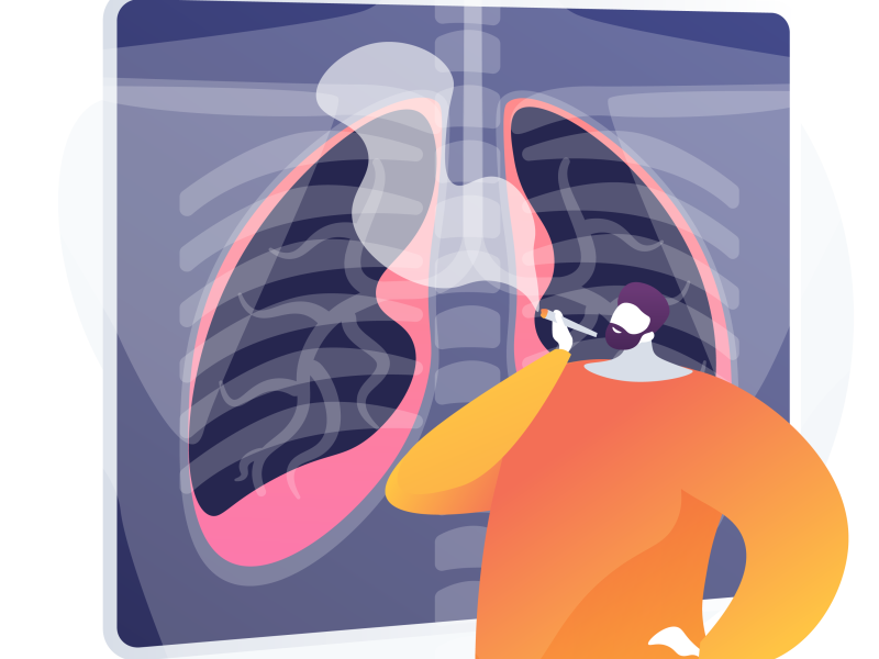 Los fumadores de marihuana muestran mayores tasas de  enfisema y enfermedades pulmonares