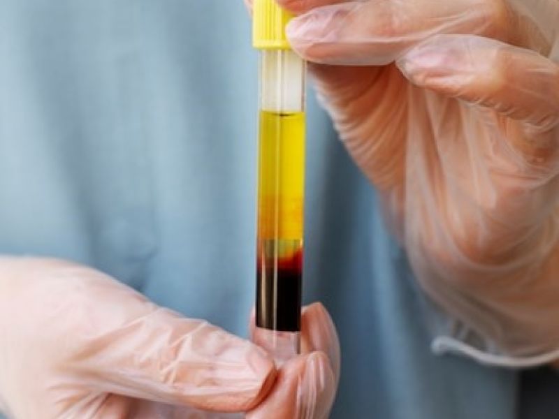 ¿Qué es medicina del plasma?