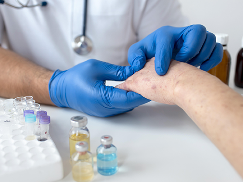 Nuevo medicamento para la psoriasis