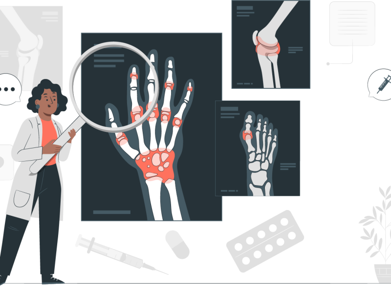 Diagnóstico concomitante de fibromialgia y trastornos del tejido  conectivo: Revisión sistemática