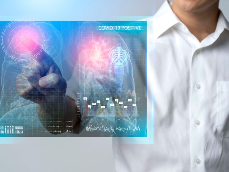 Inteligencia artificial para la evaluación de nódulos pulmonares indeterminados